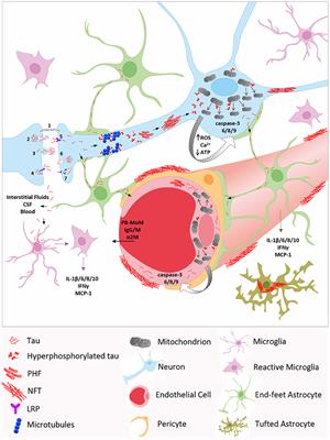 Impact of Tau on Neurovascular Pathology in Alzheimer's Disease